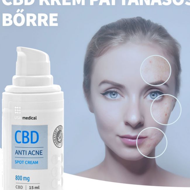 CBD krém pattanásos bőrre 800 mg CBD | 15 ml